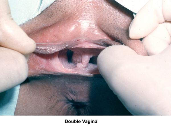 ugly black vagina finder