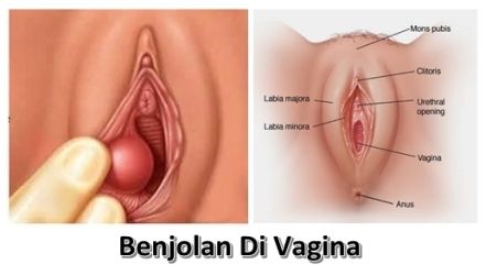 macam macam jenis vagina