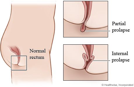 inside female anus