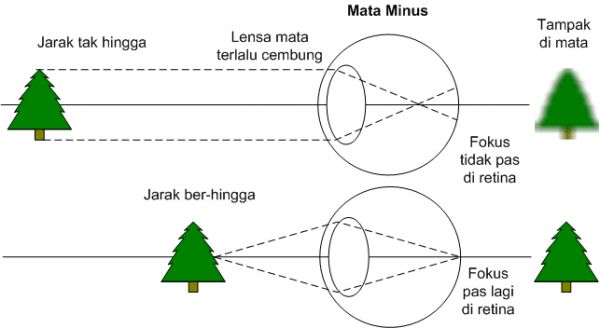 foto tempek mojokerto